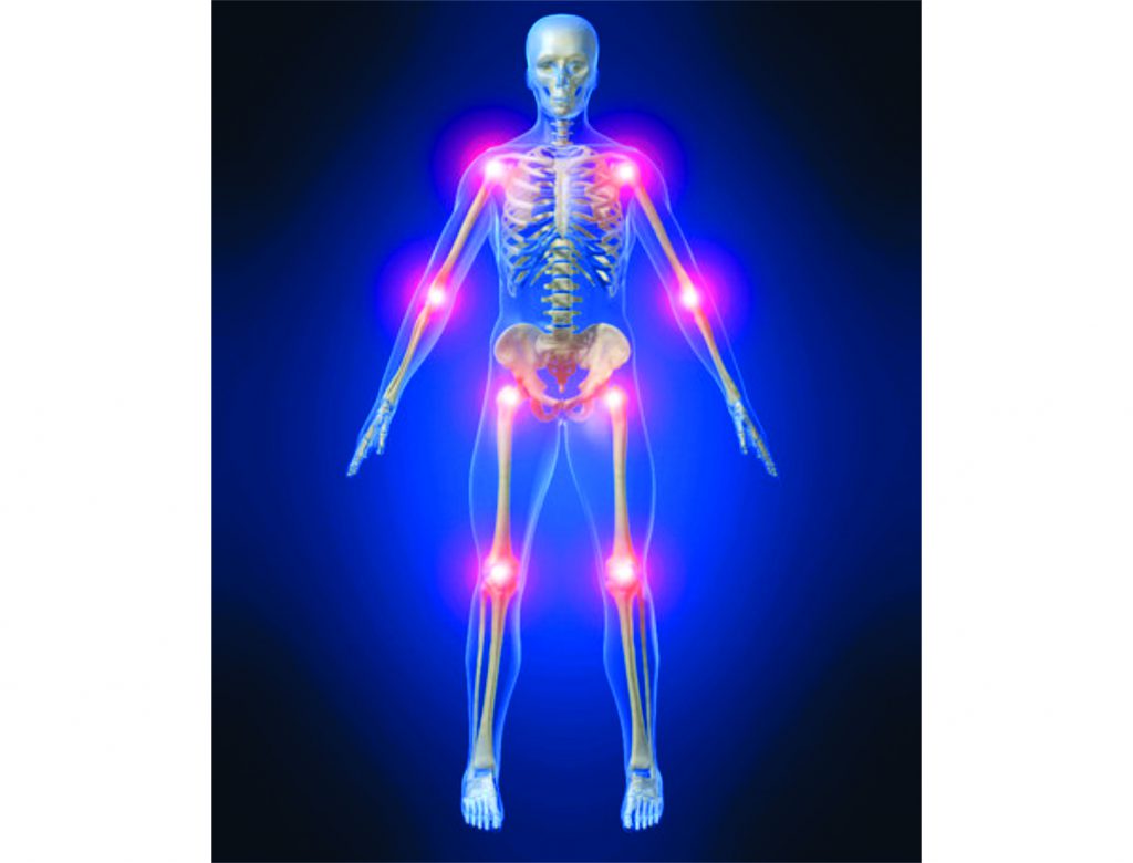 Pesquisa de Corpo Inteiro com Iodo 123